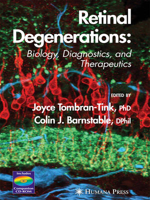 cover image of Retinal Degenerations